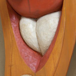 Rational brawny heart (Close up)                                                                                                                                                                        